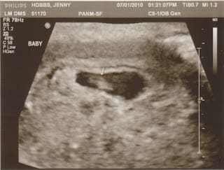 Our biggest surprise ever...